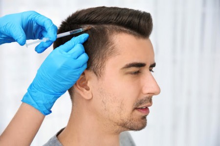 opération greffe de cheveux